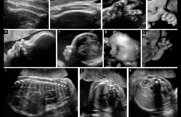 m/سونو بارداری در تهران پارس