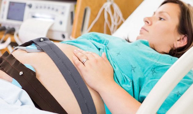 m/نوار قلب جنین NST در تهران پارس