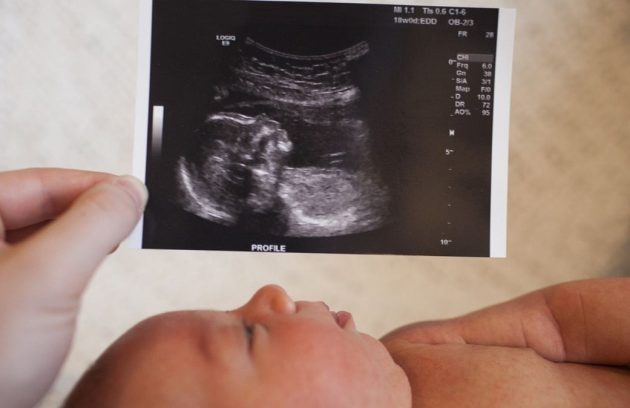 m/اولین سونوگرافی بارداری