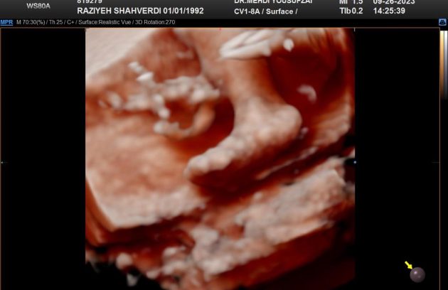 m/سونو کالر داپلر اکرتا