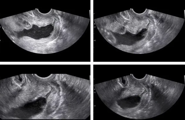 m/سونوگرافی آنومالی چیست؟