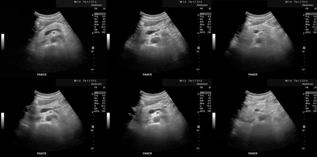 m/سونوگرافی کبد و کیسه صفرا