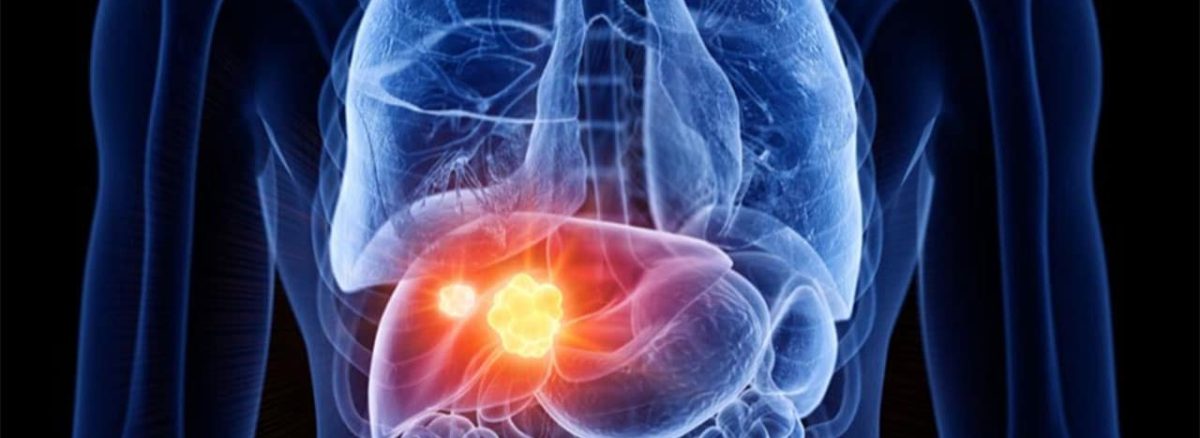 m/سونوگرافی کبد و کیسه صفرا