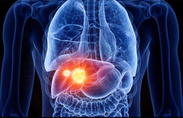 m/سونوگرافی کبد و کیسه صفرا