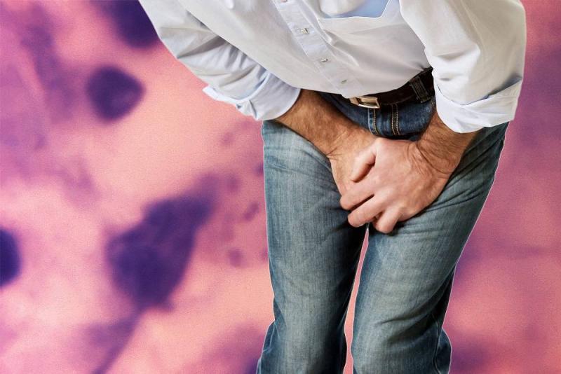 m/عکس rug چیست؟