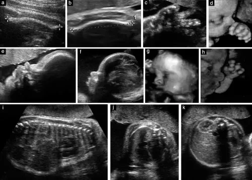 m/سونوگرافی آنومالی در تهران