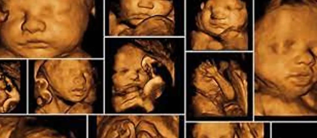 m/سونوگرافی داپلر تهران